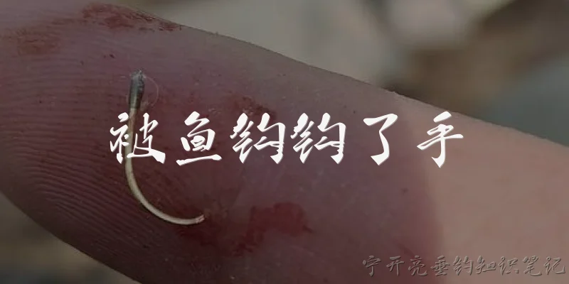 被鱼钩钩了手:被鱼钩钩了手应该怎么紧急处理?